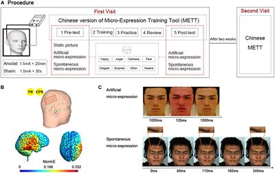 Transcranial Direct Current Stimulation Over the Right Temporal Parietal Junction Facilitates Spontaneous Micro-Expression Recognition